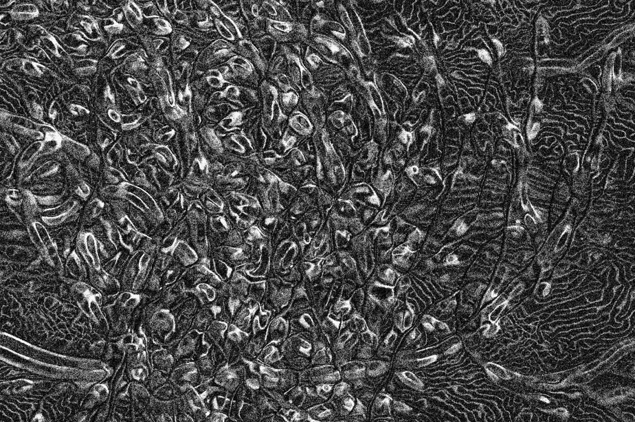 Trypophobia and Other Epithelial Reveries