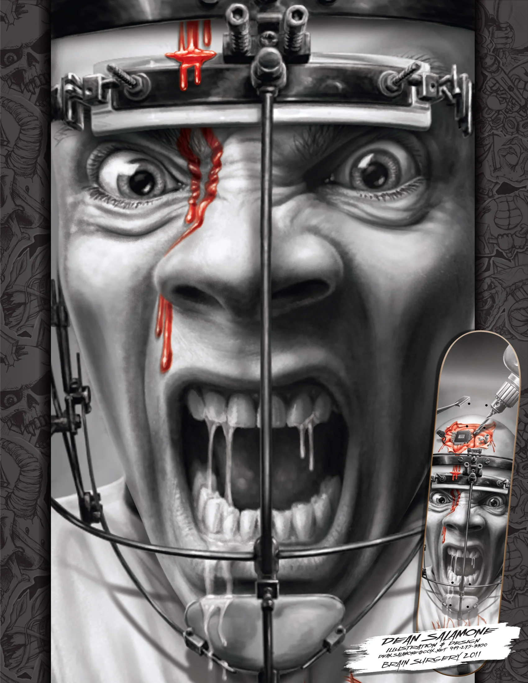 BrainSurgery portfolio-page.jpg