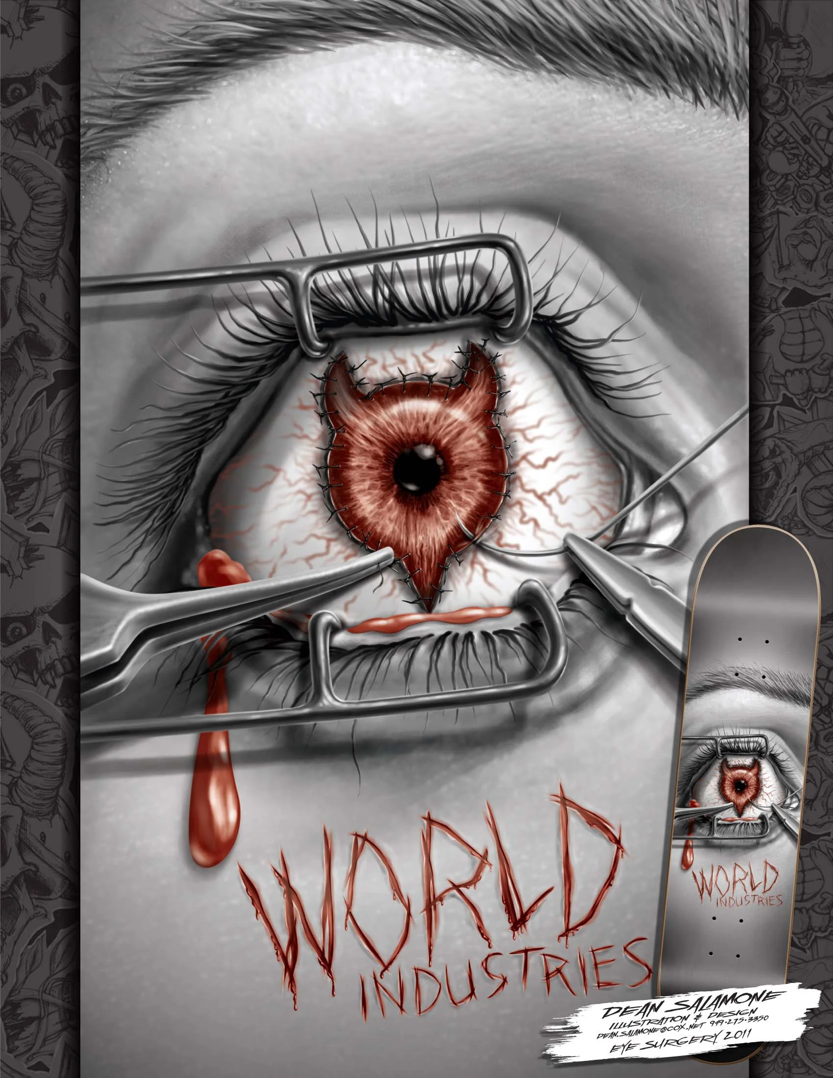 EyeSurgery portfolio-page_sml.jpg