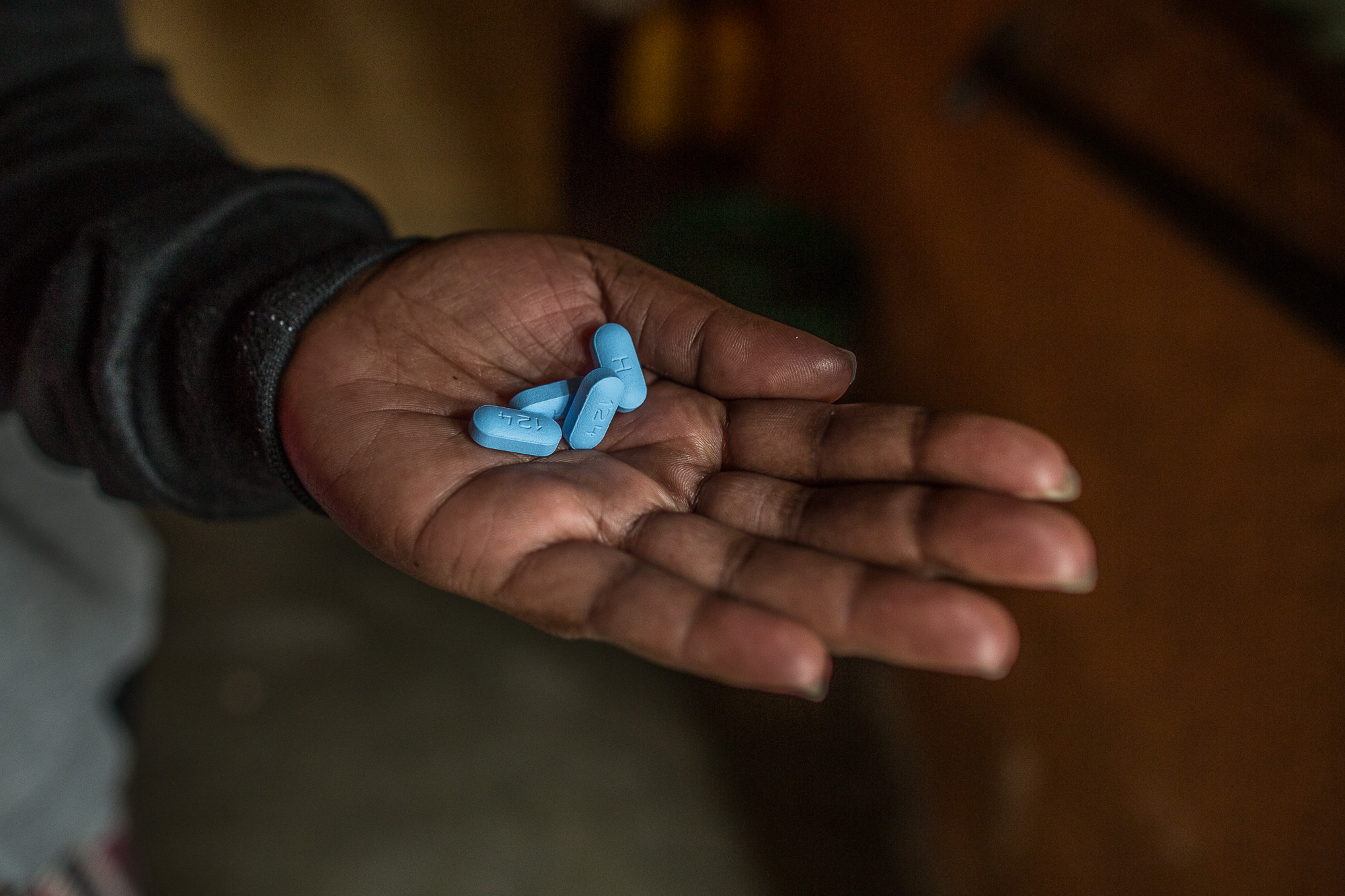 Pre-Exposure Prophylaxis (PreP) reduces the chances of contracting HIV.