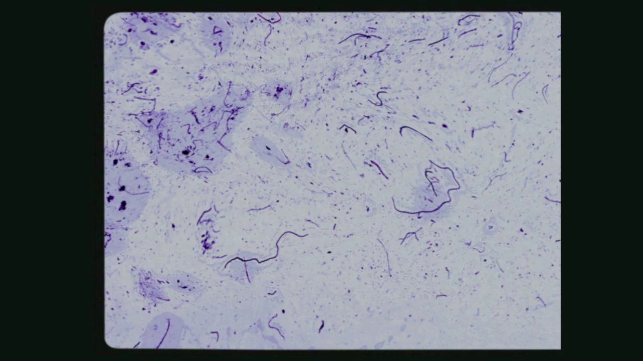 In Between Inception I & II 2012