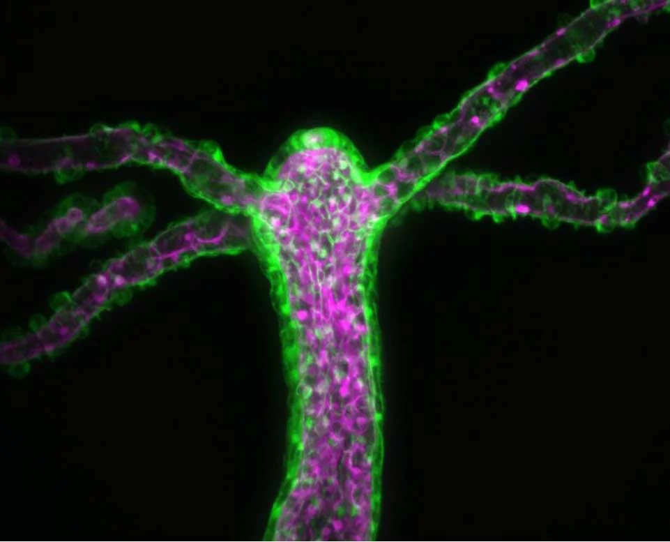 The Hydra Gets a New Mouth With Every Meal