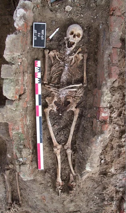 Old Teeth Tell New Stories About People Who Didn’t Get Enough Sun