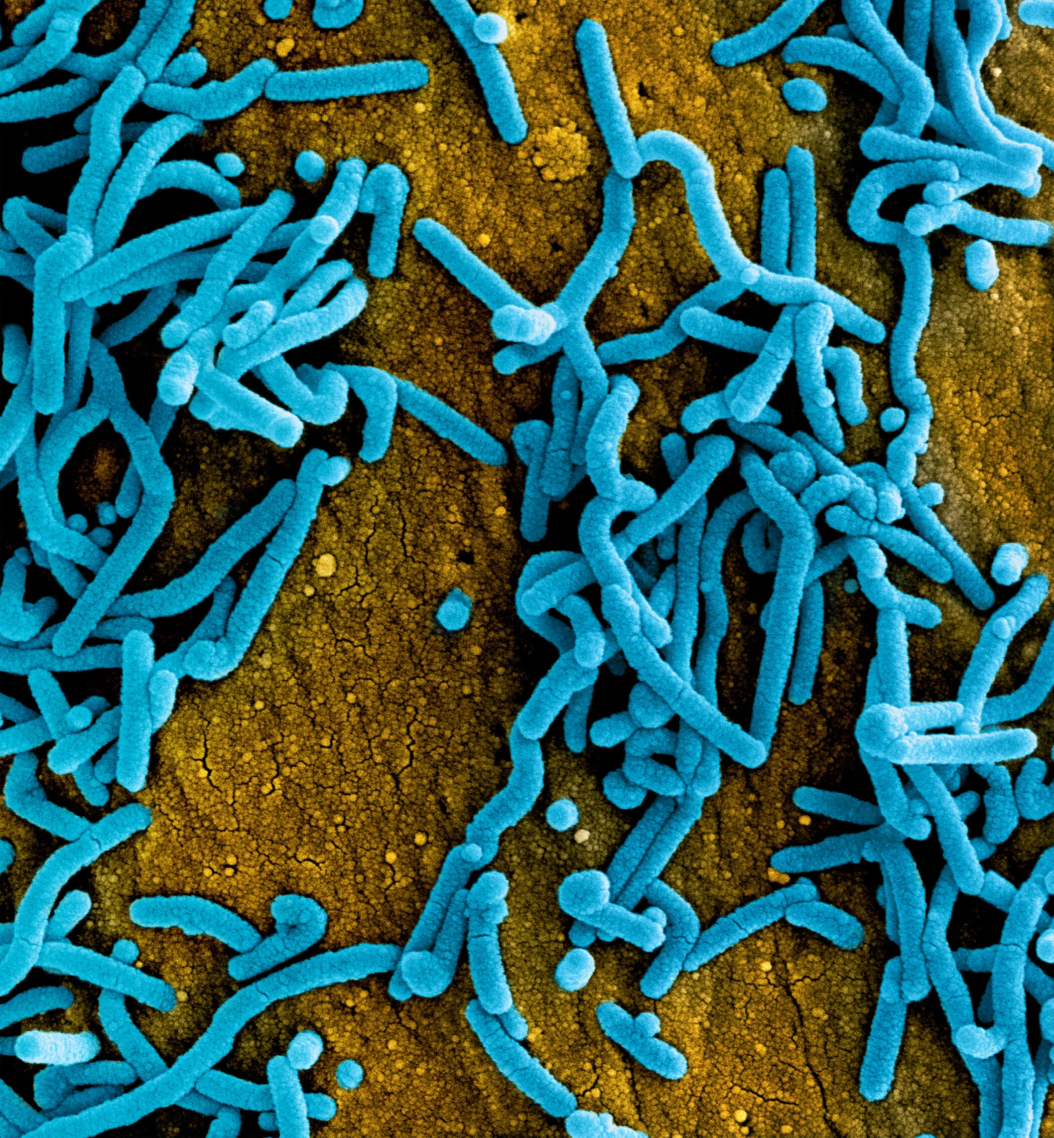 Ebola virus