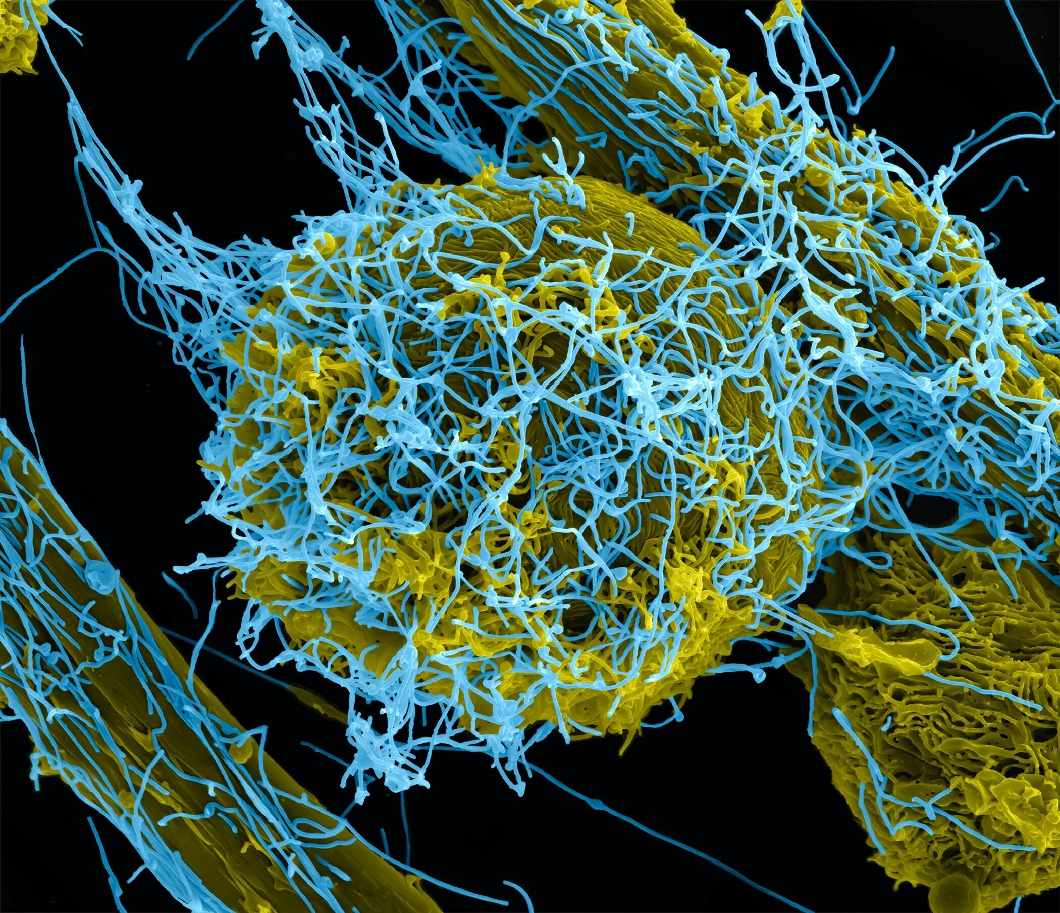 Ebola virus