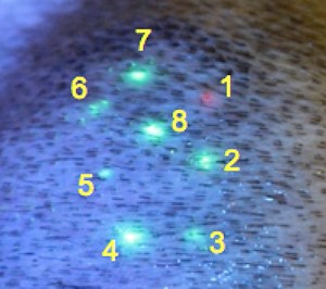 Figure 2 . Delivery of 8 unique drugs is visualized with a special light source. 