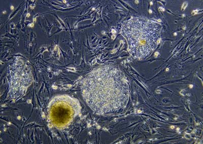 stem-cell-4.jpg