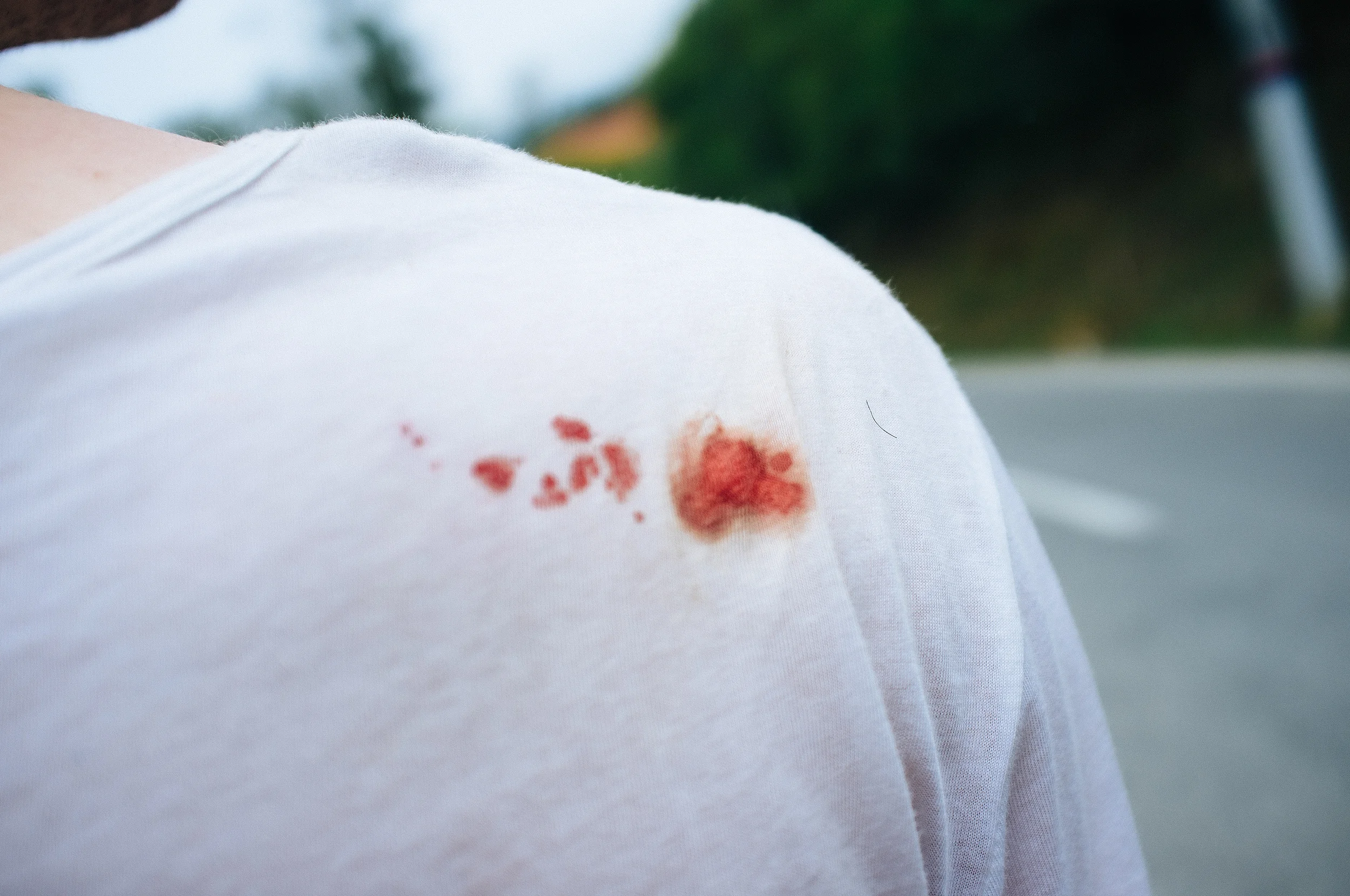 I didn't even notice it until Hannes pointed the blood out. It apparently got squished under my pack strap.