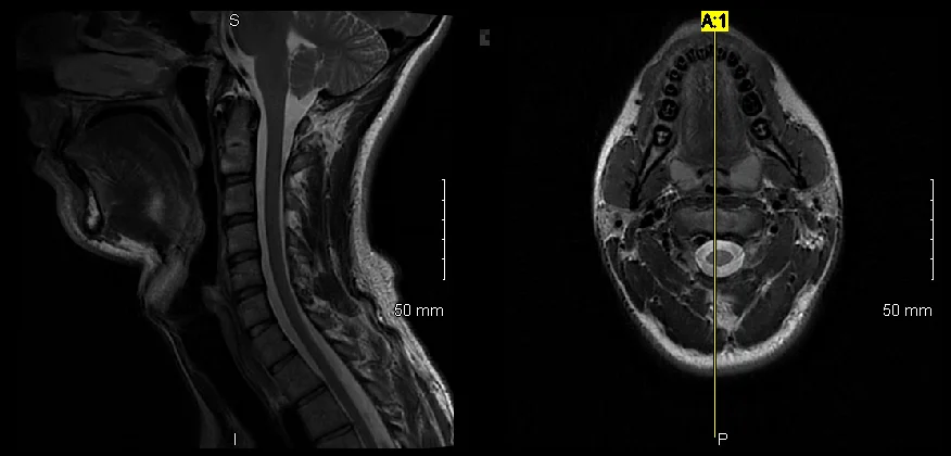 MRI Partial Image.jpg