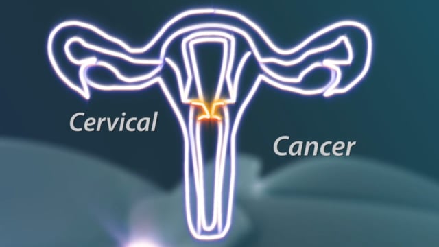 What Every Woman Should Know - Cervical Cancer Module