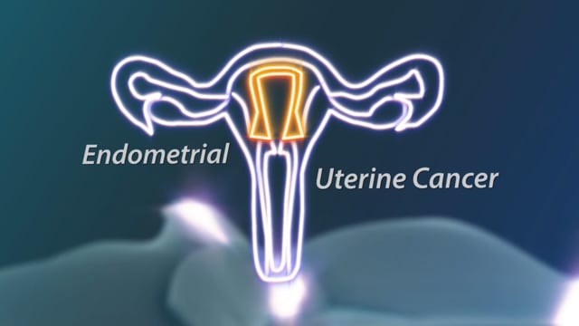 What Every Woman Should Know - Endometrial and Uterine Cancer Module