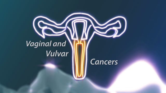 What Every Woman Should Know - Vaginal and Vulvar Cancers Module
