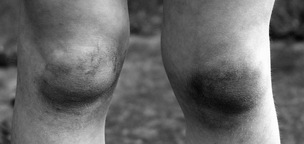 Knees.jpg