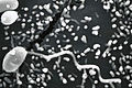 Scanning electron micrograph of a microsporidian spore with an extruded polar tubule inserted into a eukaryotic cell. The spore injects the infective sporoplasms through its polar tubule.