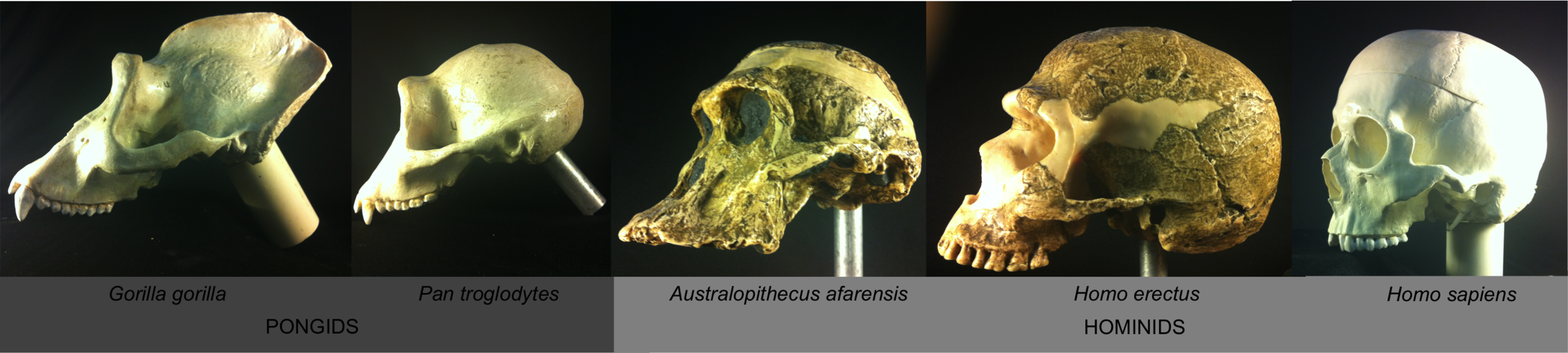 Spinal column insertion angles at the foramen magnum of hominids vs. pongids. 