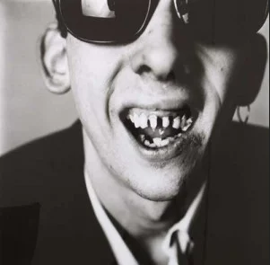 bad teeth.jpg