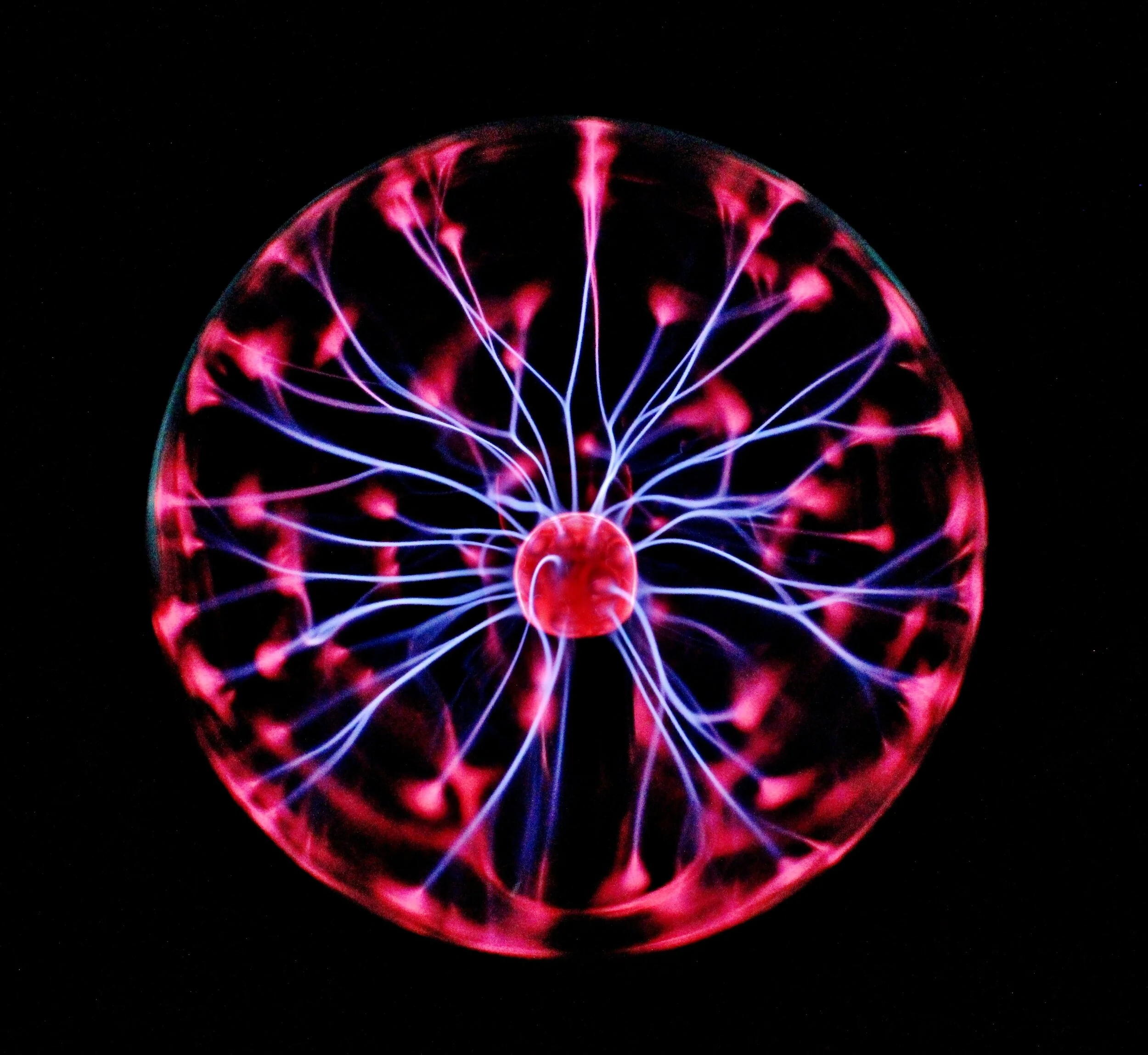 PKU brain.jpg