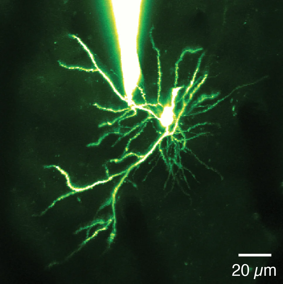 cover_dendrite_patch.jpg