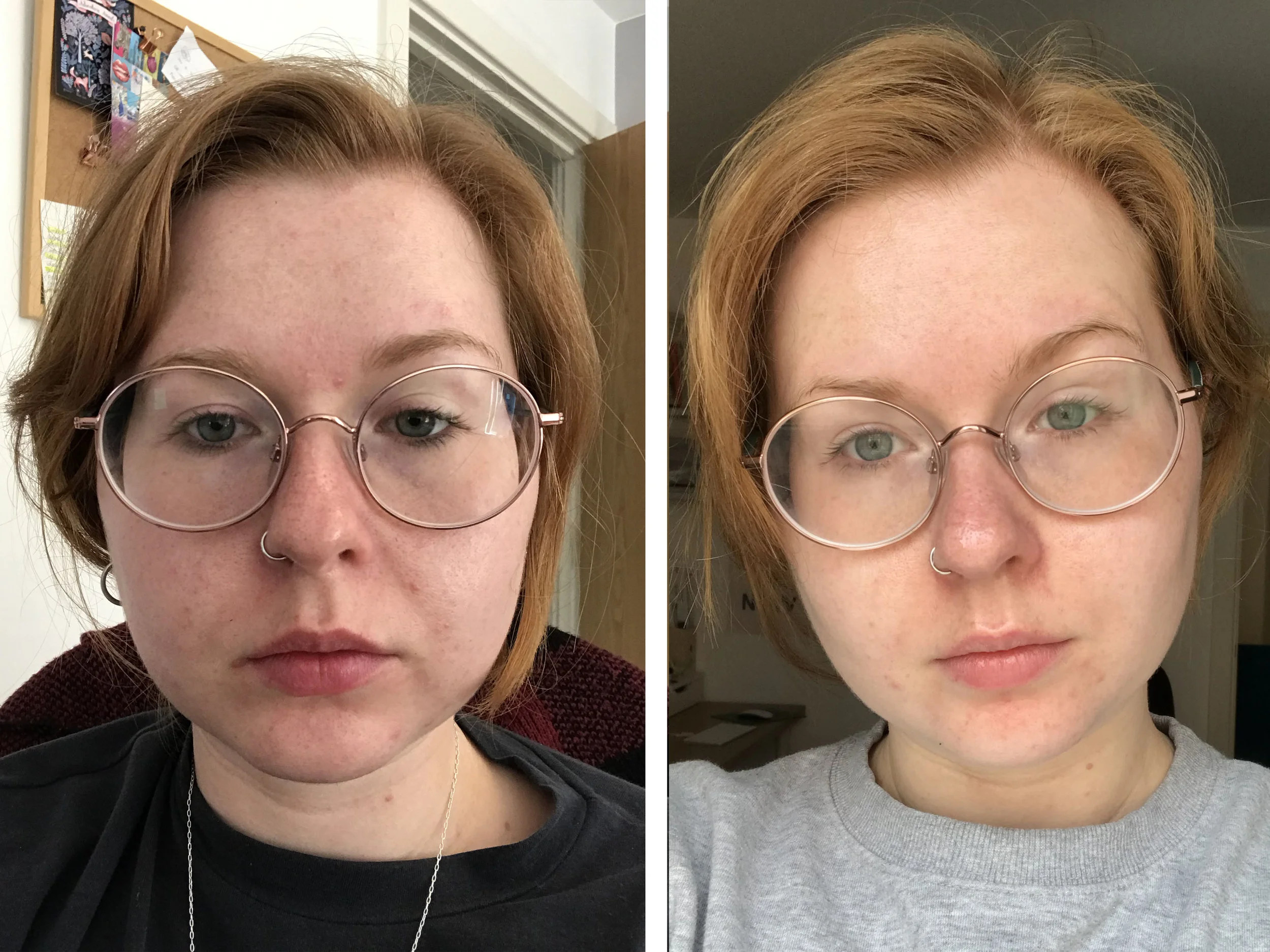 before after.jpg