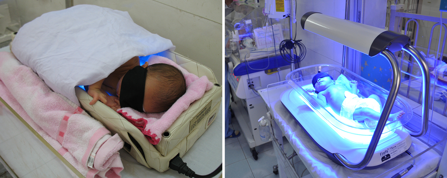 Left: The Bilibed prototype was not well trusted due to its outdated aesthetic. Right: Firefly is designed to look like a modern medical device.