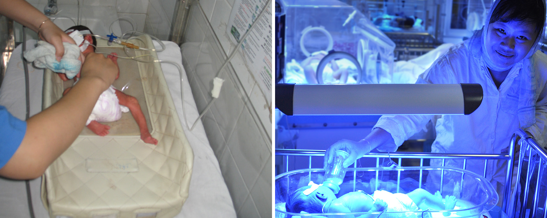  Left: The Bilibed prototype didn’t look safe and comfortable to many caregivers. Right: The Firefly device better secures the infant and surrounds them in soft curves.