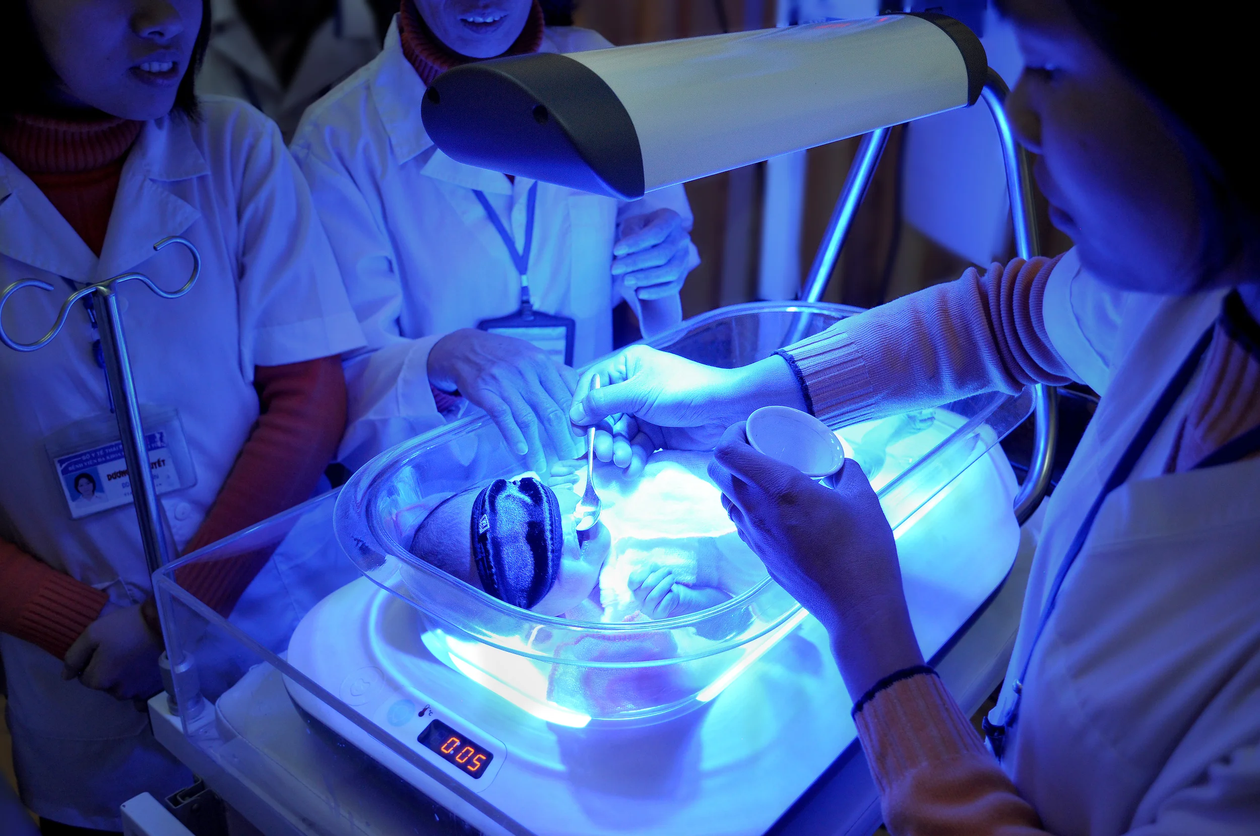 биоптрон аппарат физиотерапии. фототерапия уфо. ультрафиолет в медицине. световая медицина. световая медицина.