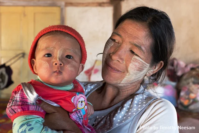 Myanmar Jaundice Study Reveals Different, More Severe Disease in Developing Countries