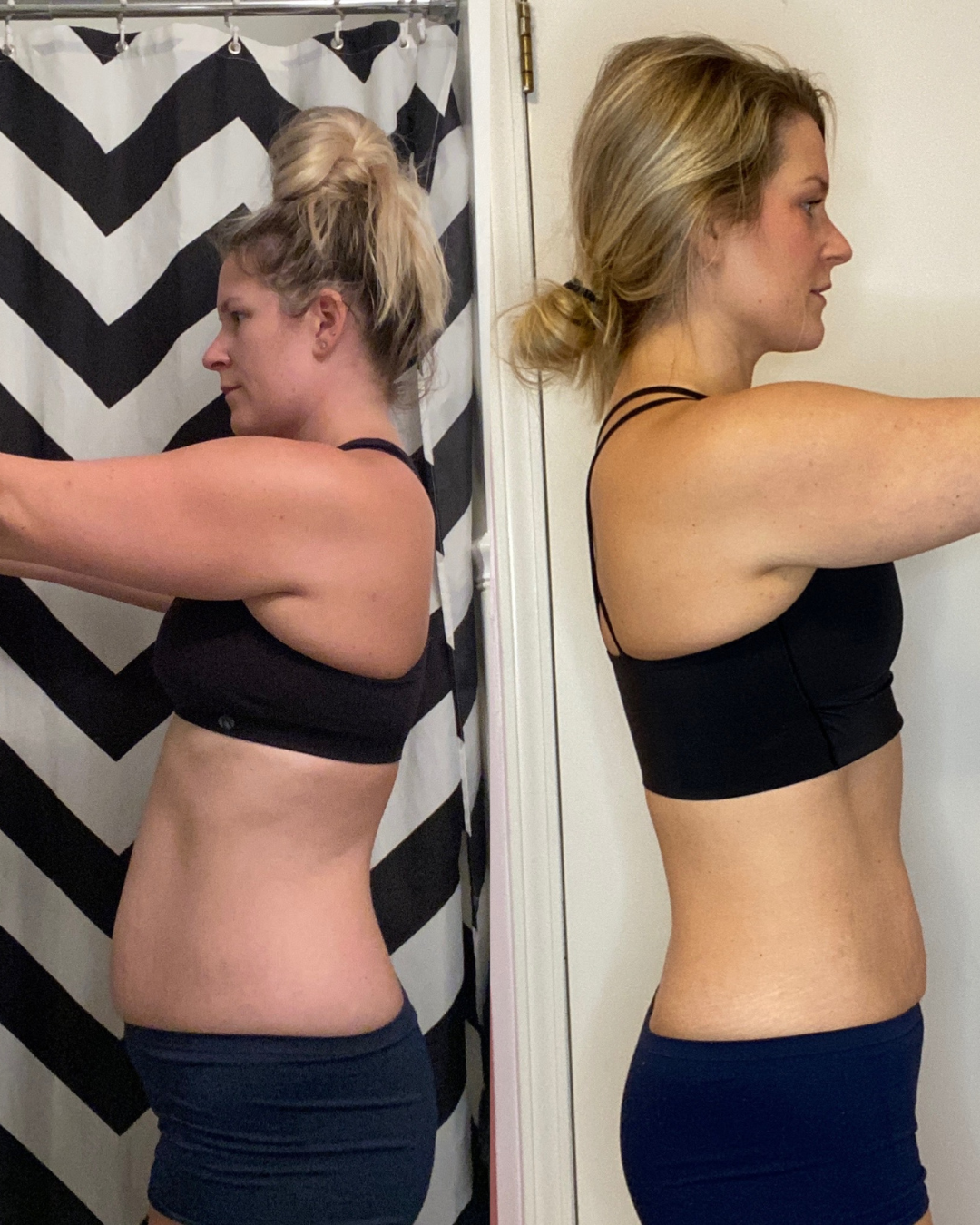 Unveiling the Mystery: Understanding Core and Pelvic Floor Dysfunctions