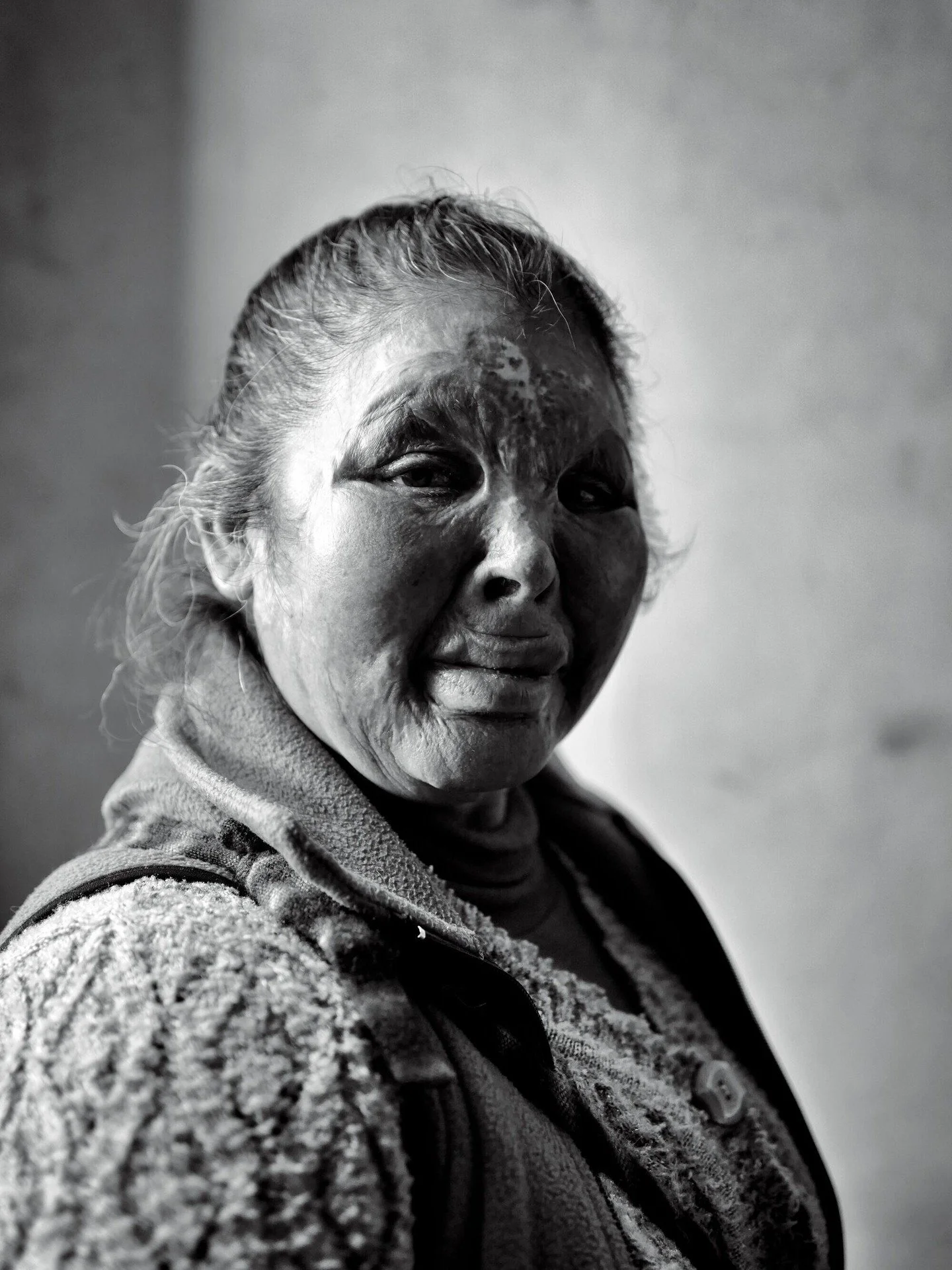 Gregoria. A tireless evangelist working among the Quechua people of Peru. Her face disfigured in a fire accident as a child. Beautiful spirit and such a heart for her people.