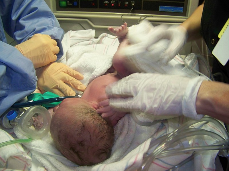 Dallas as a baby born addicted to Methadone