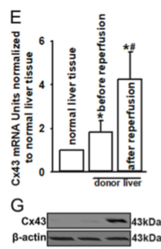 图1所示。正常或供肝再灌注前和再灌注后Cx43 mRNA和蛋白水平。