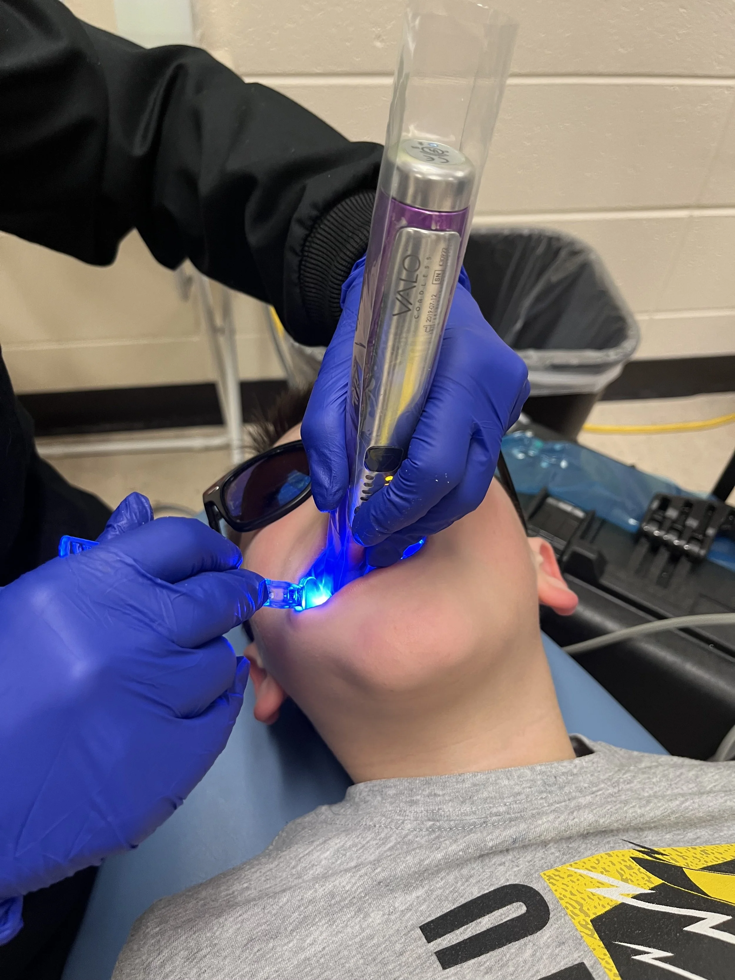 Curing Light
