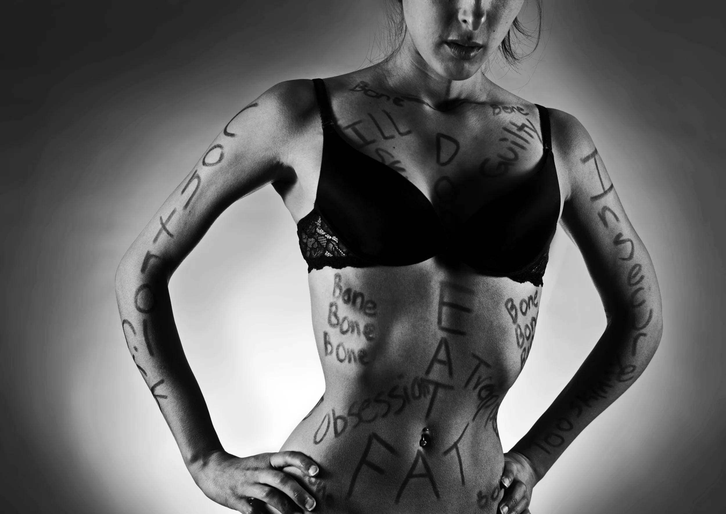 Anorexia