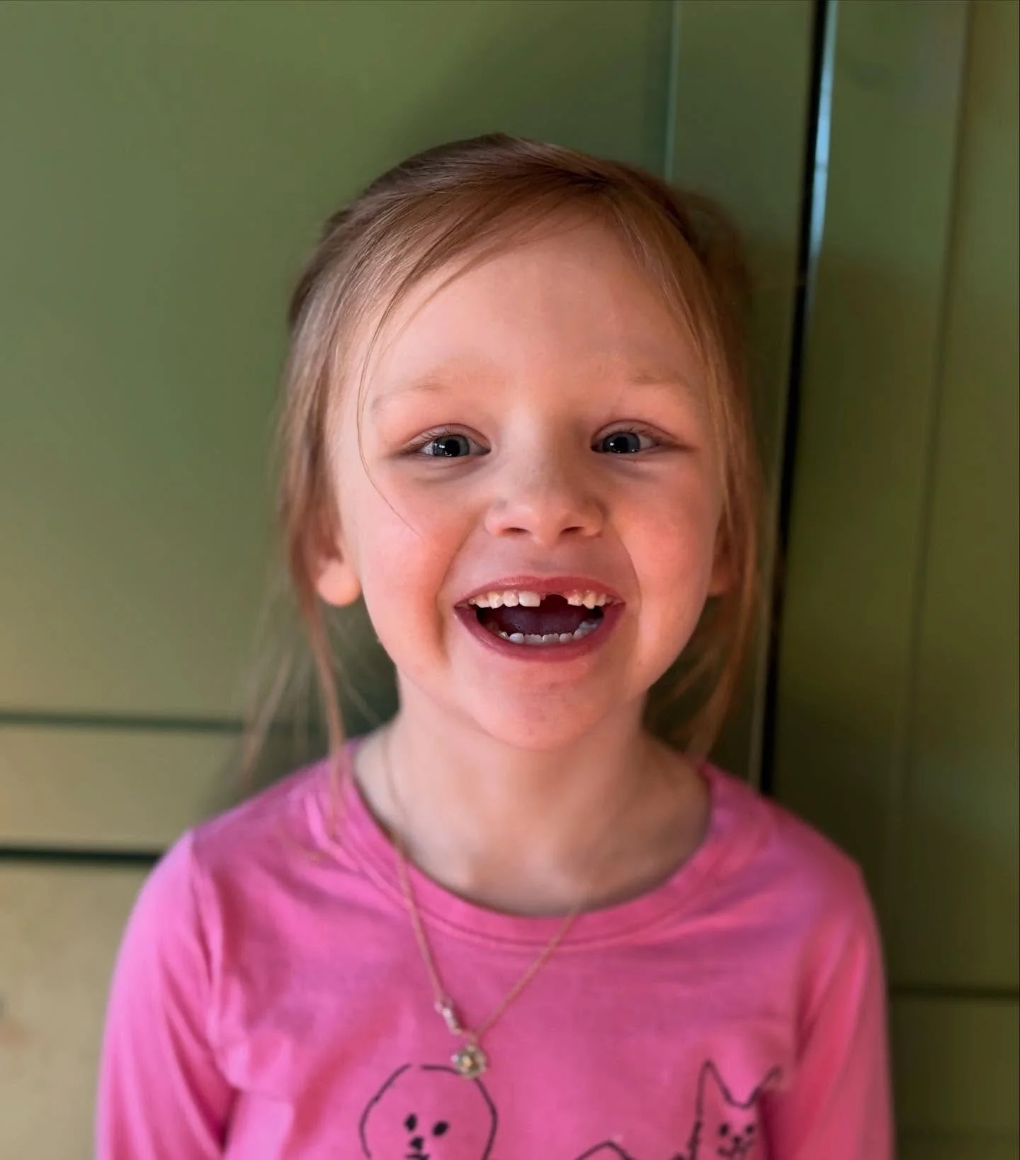 Junie lost her first top tooth. She&rsquo;s over the moon excited to show everyone tomorrow! 🧚