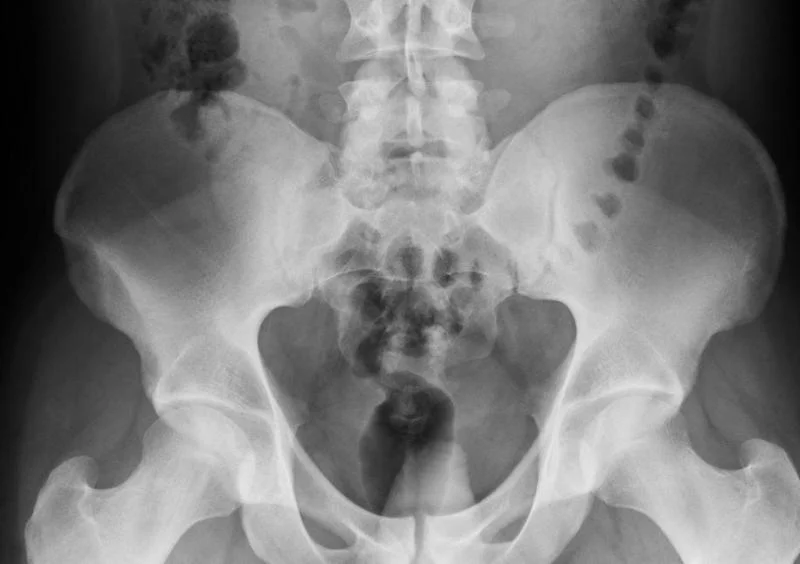 YOGA LAB: The Sacroiliac Joint