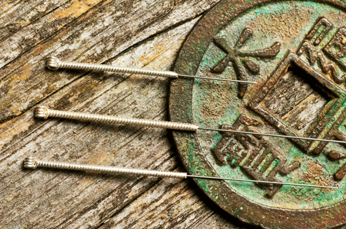 From Nixon to Michigan: A Brief History of the Legalization of Acupuncture in the U.S.