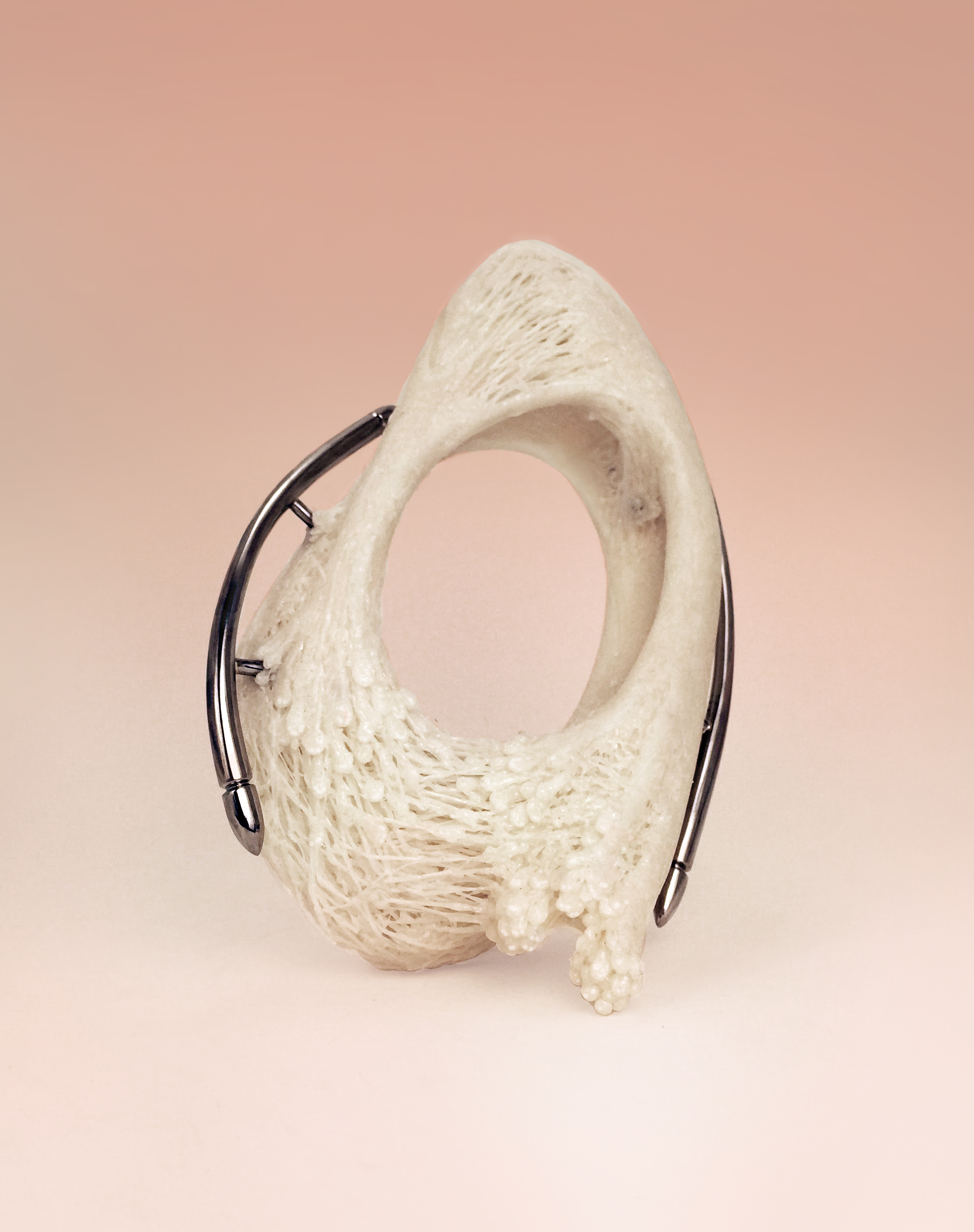 Radial Styloid Fixation #1