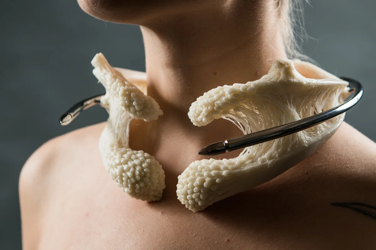 Acromial fixation