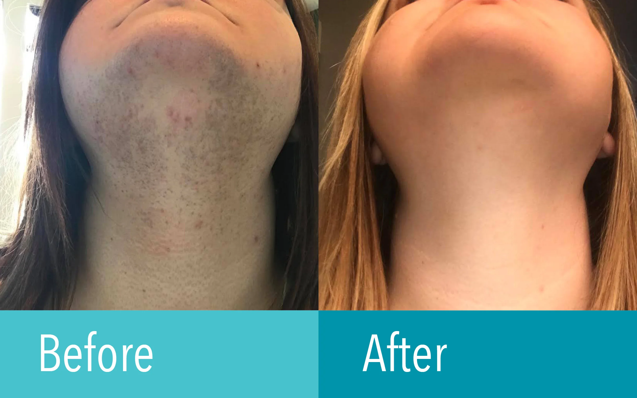 Photo courtesy of The Laser Cosmetic Center at Dermatology Associates