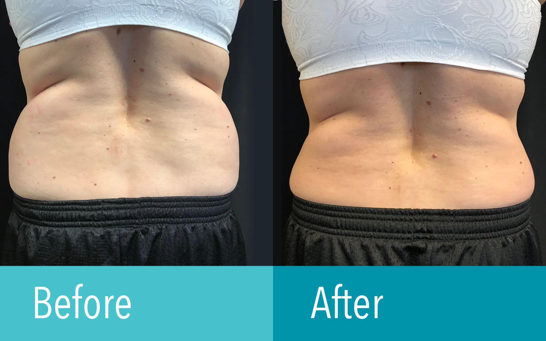 Photo courtesy of The Laser Cosmetic Center at Dermatology Associates
