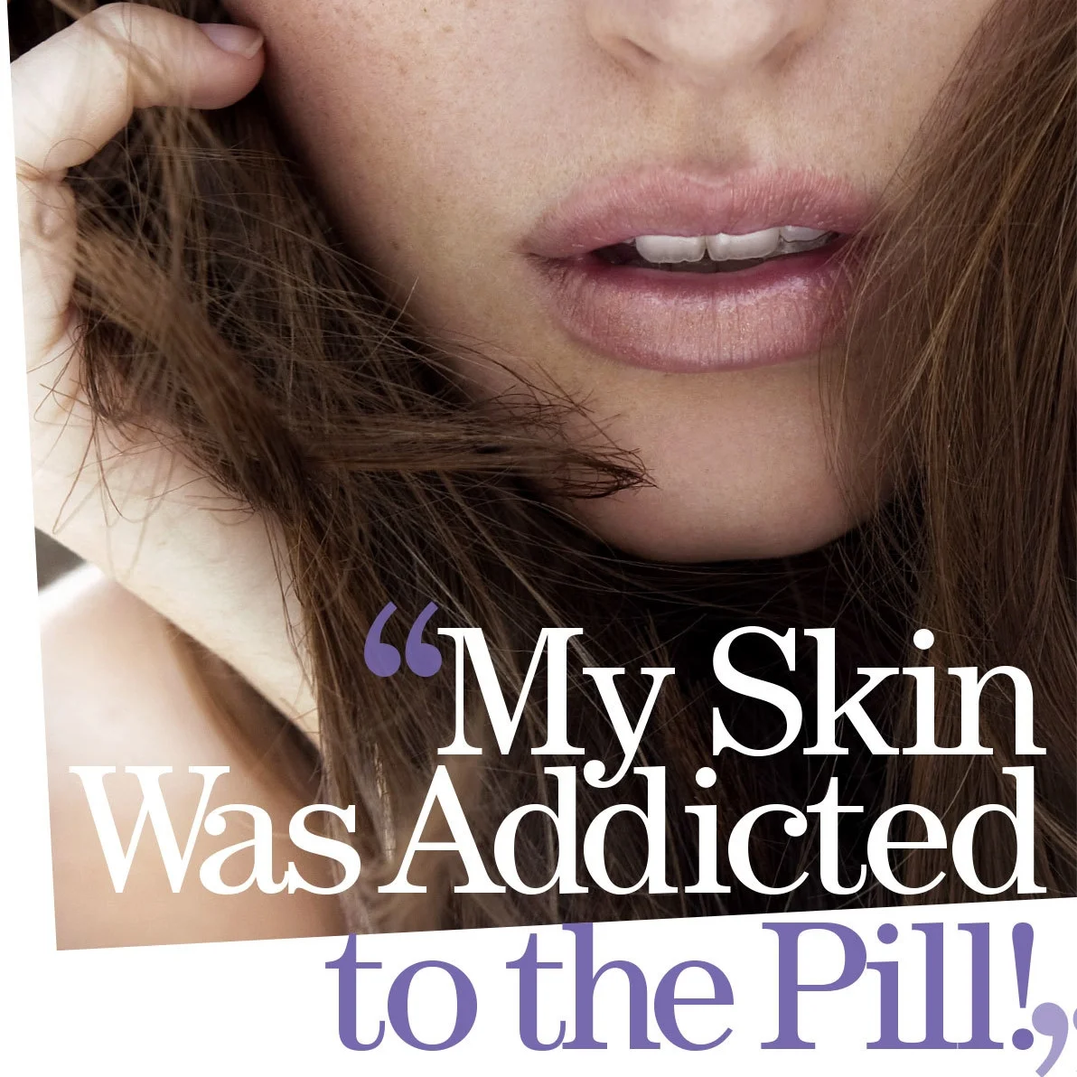 NicoleCatanese_Cosmopolitan_MySkinWasAddictedToThePill_A.jpg