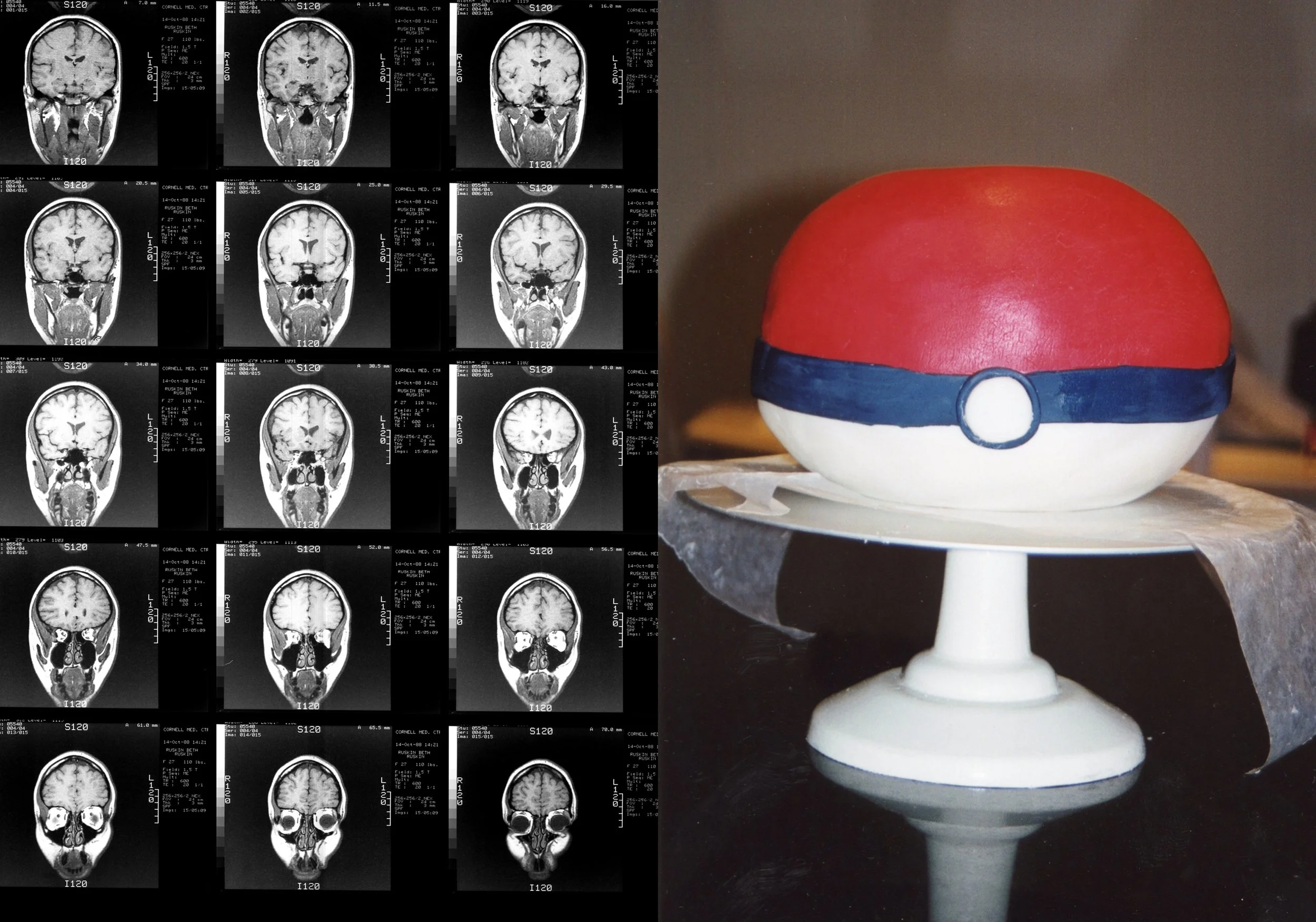 Cake MRI Book3.jpg