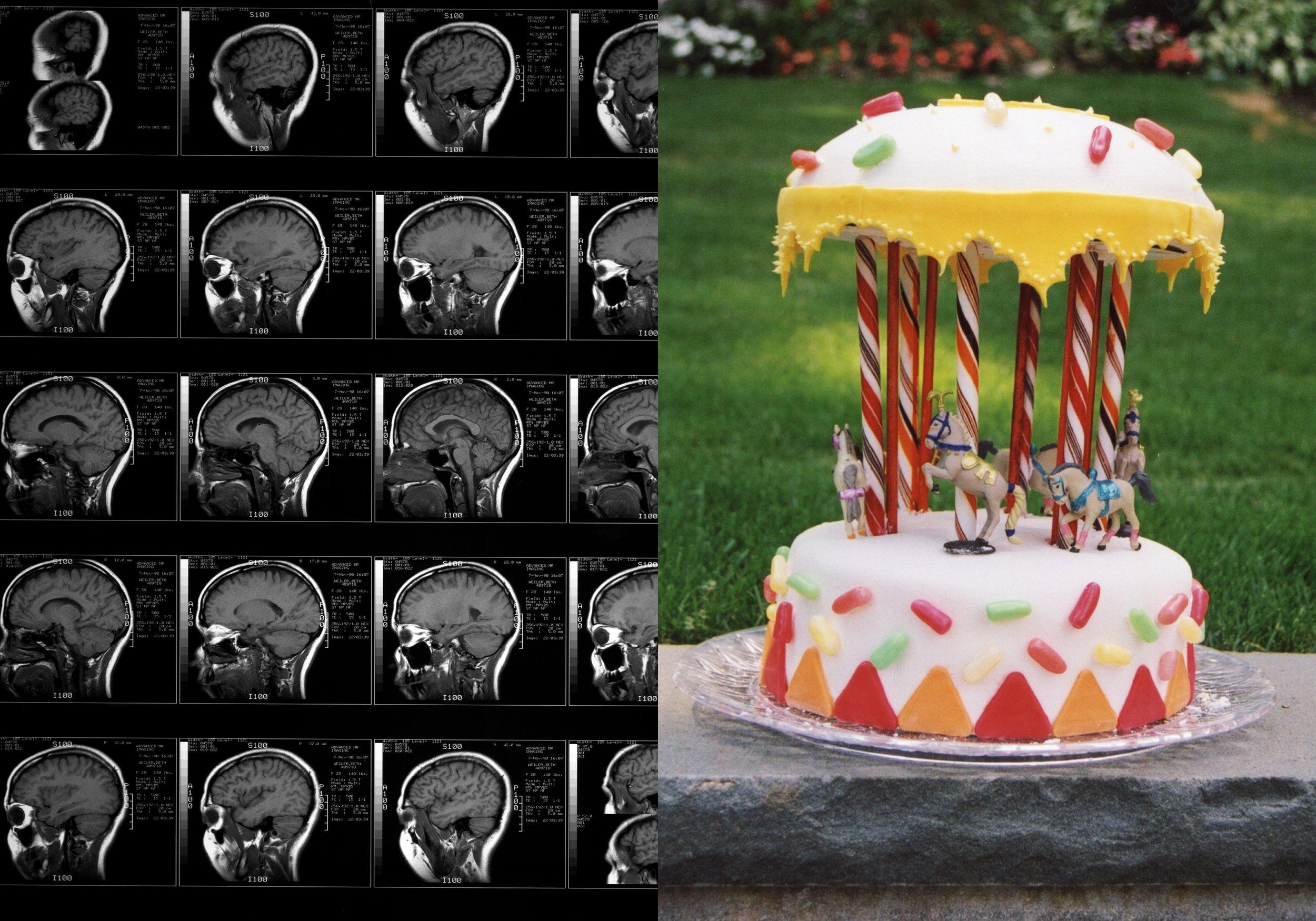 Cake MRI Book5.jpg