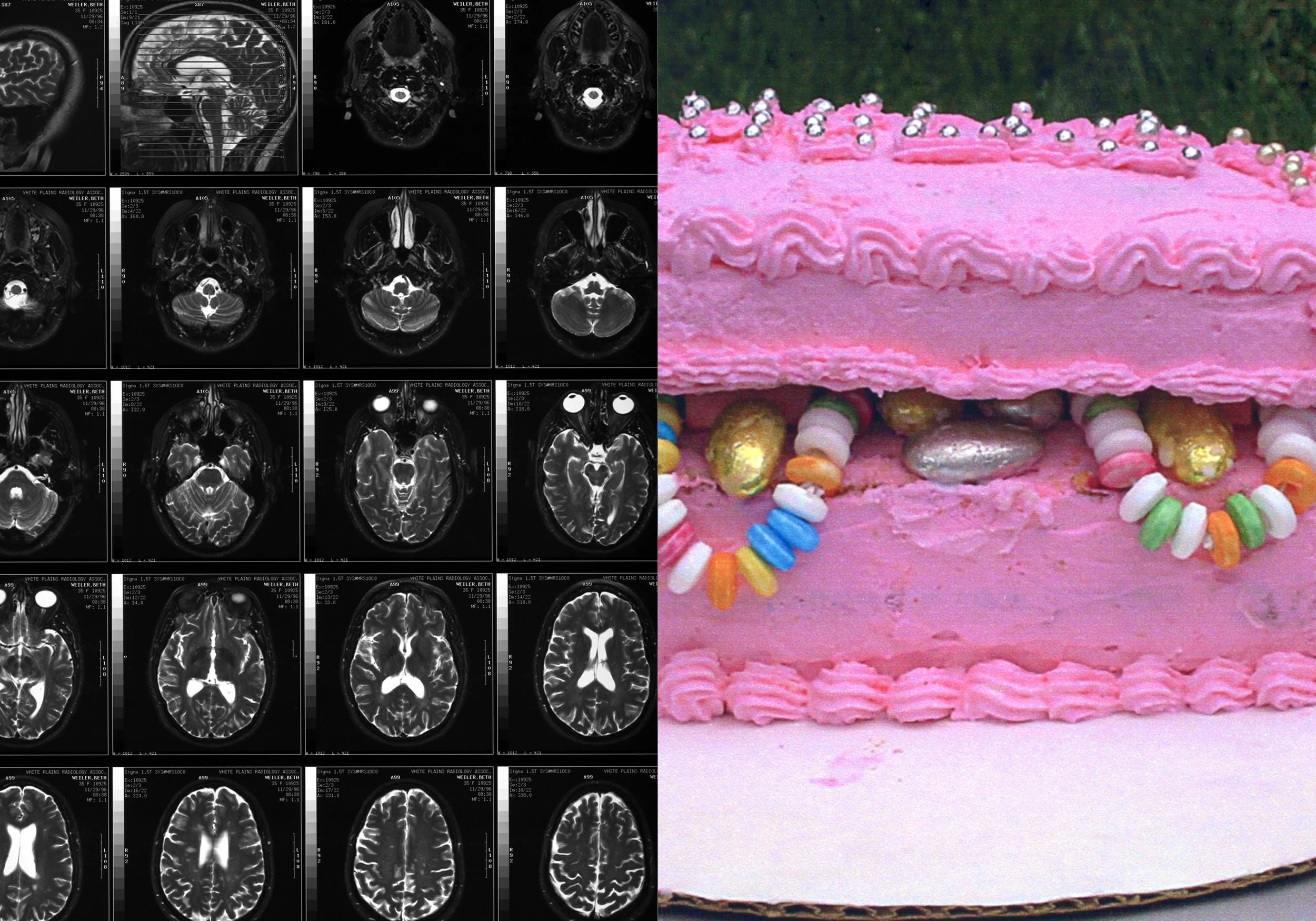 Cake MRI Book13.jpg
