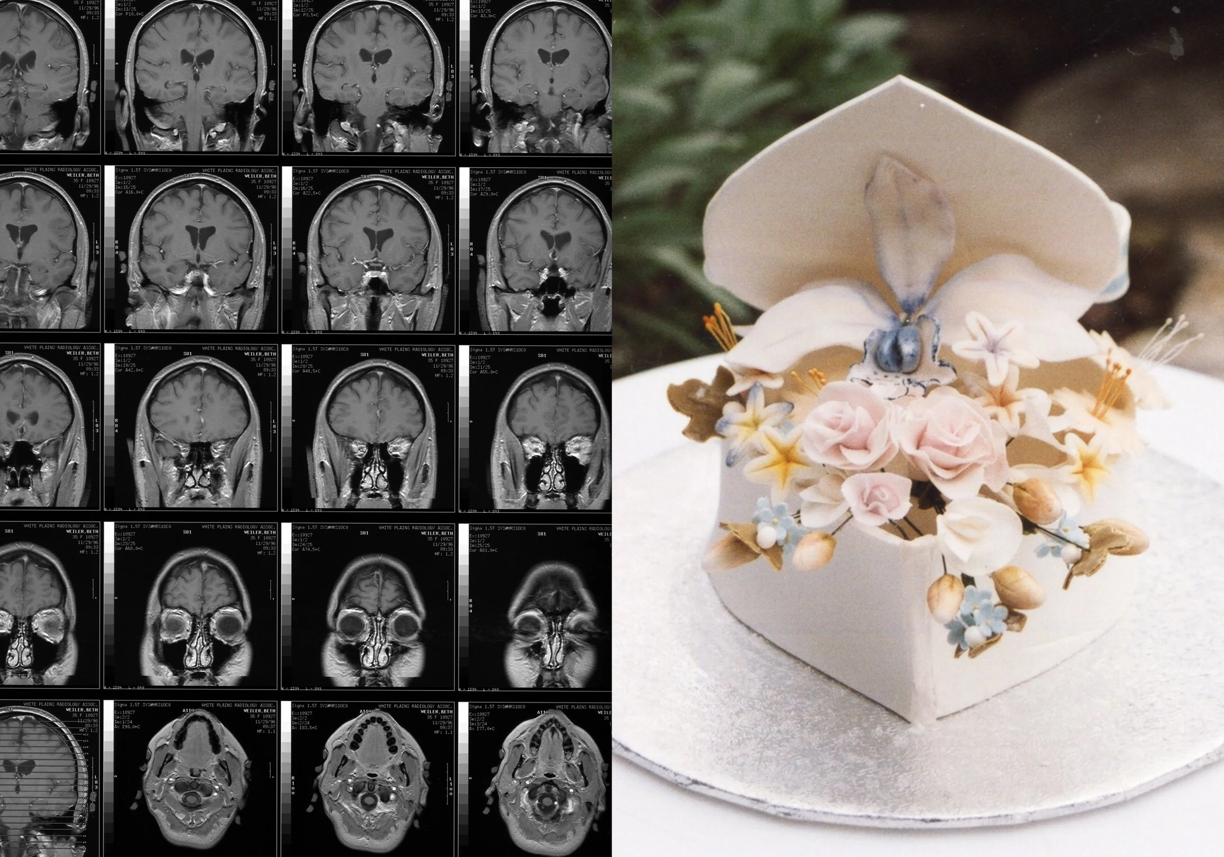 Cake MRI Book14.jpg