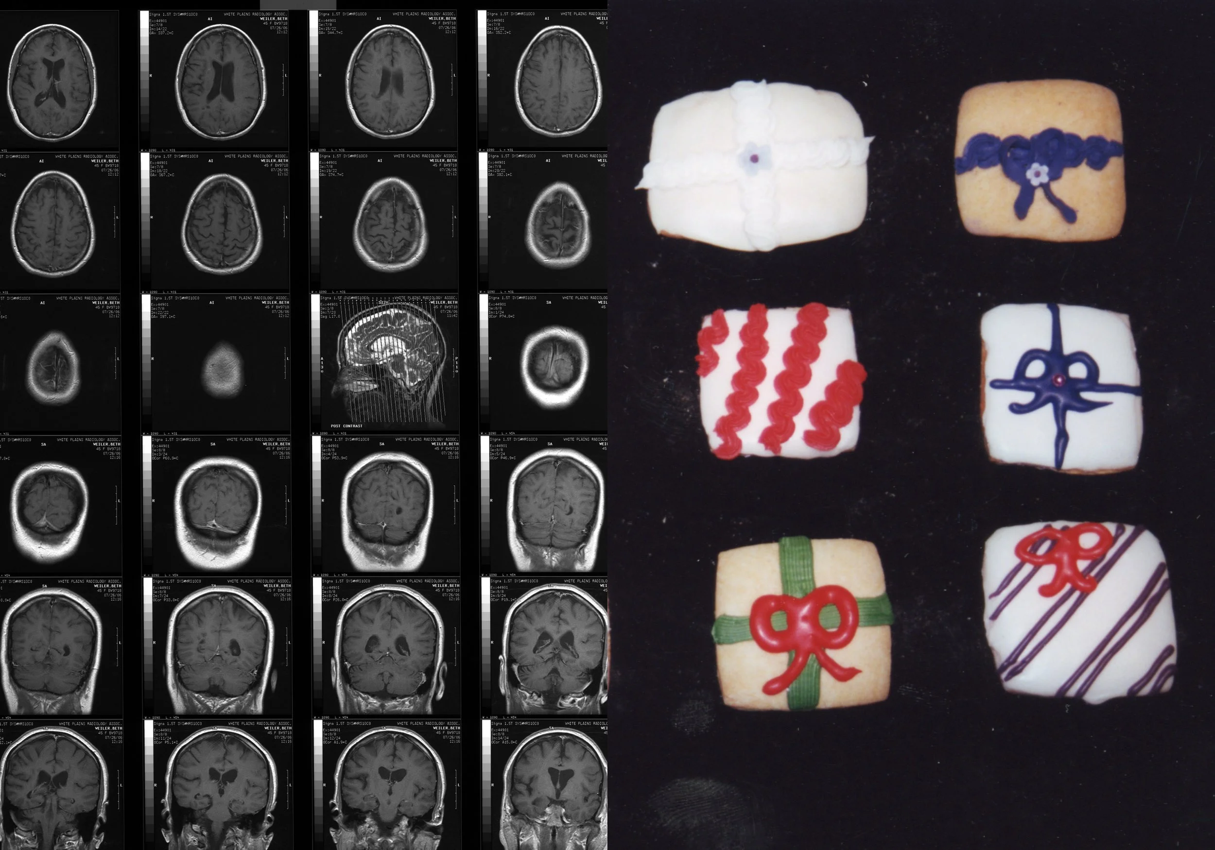 Cake MRI Book28.jpg