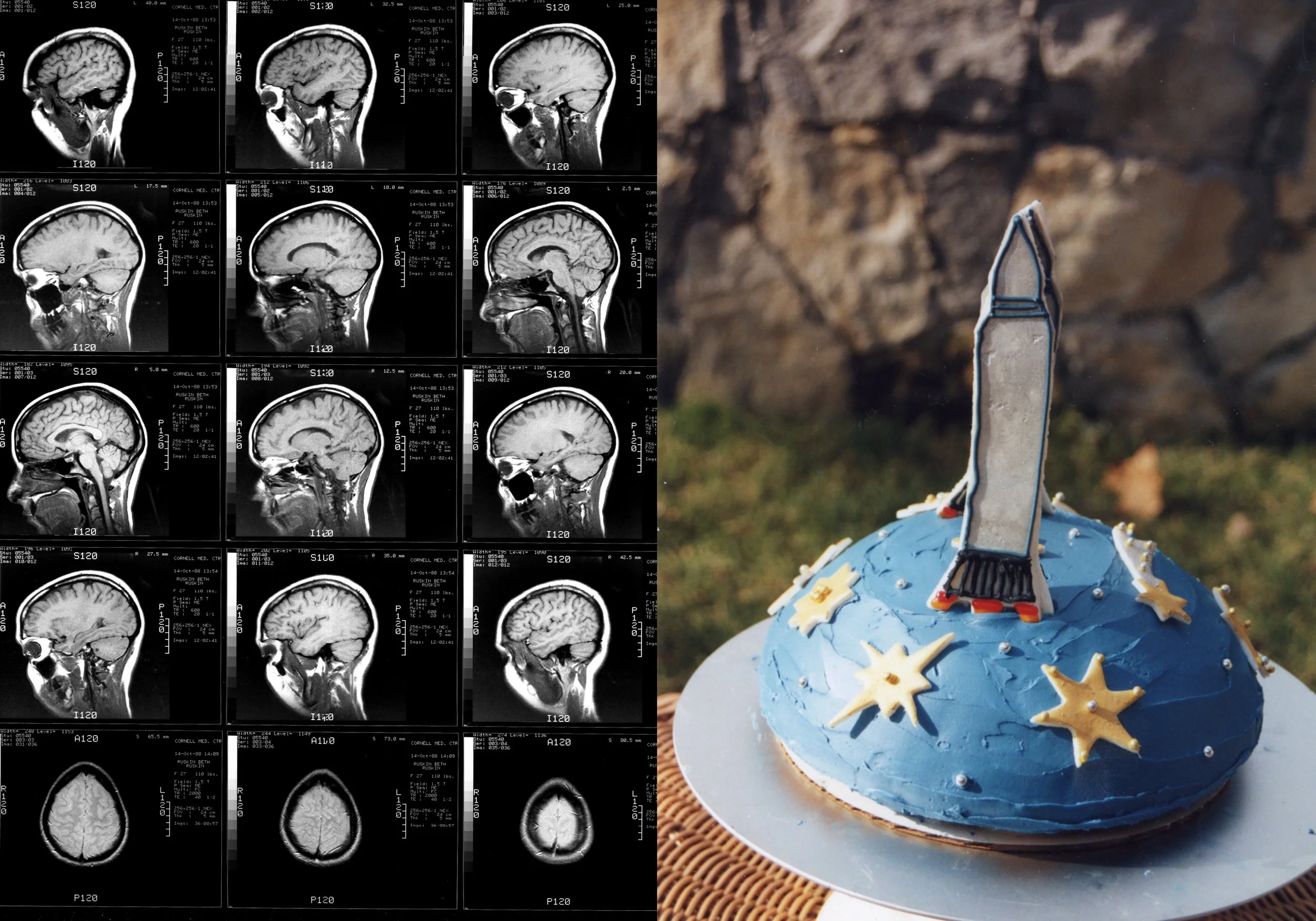 Cake MRI Book2.jpg