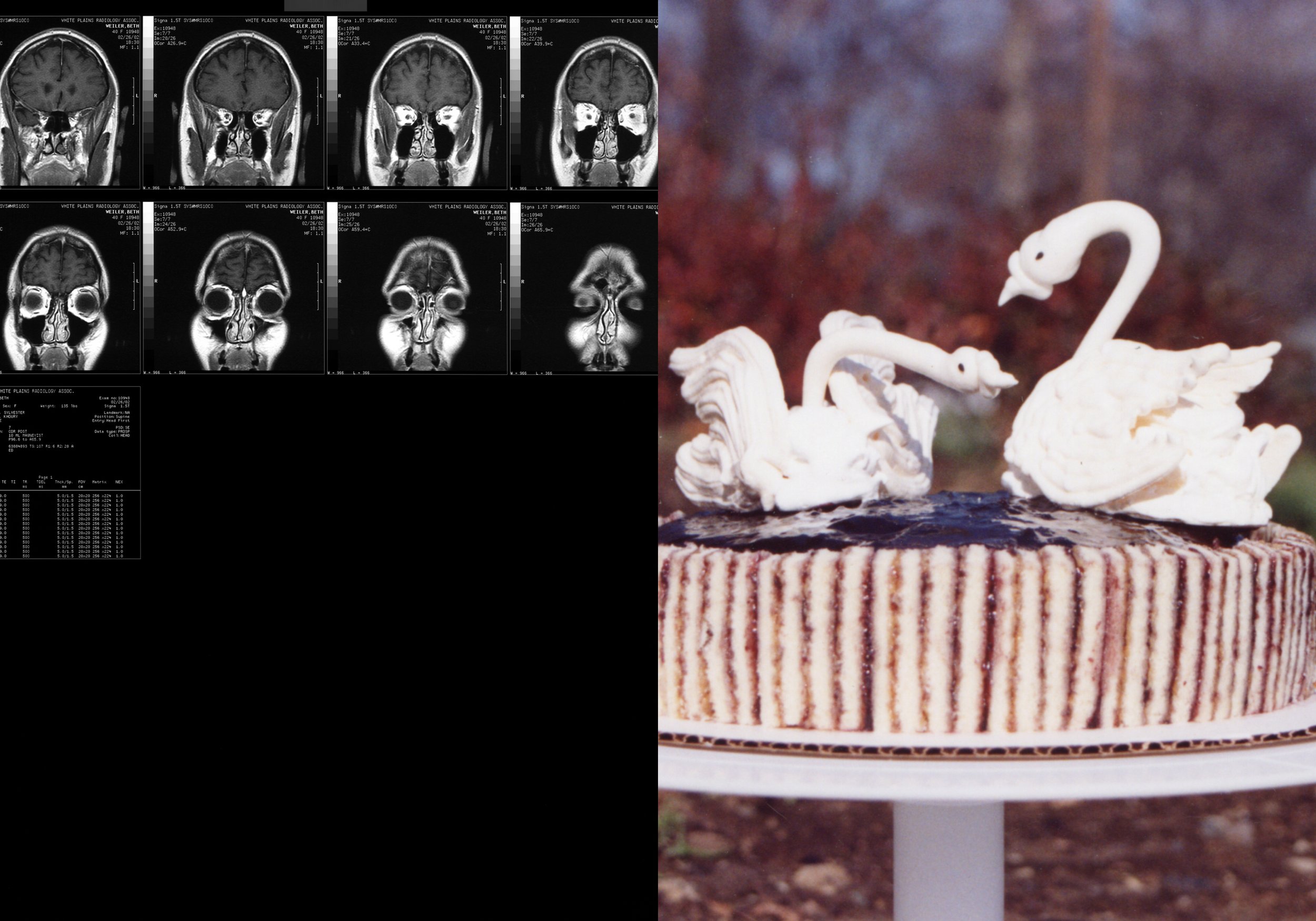 Cake MRI Book20.jpg