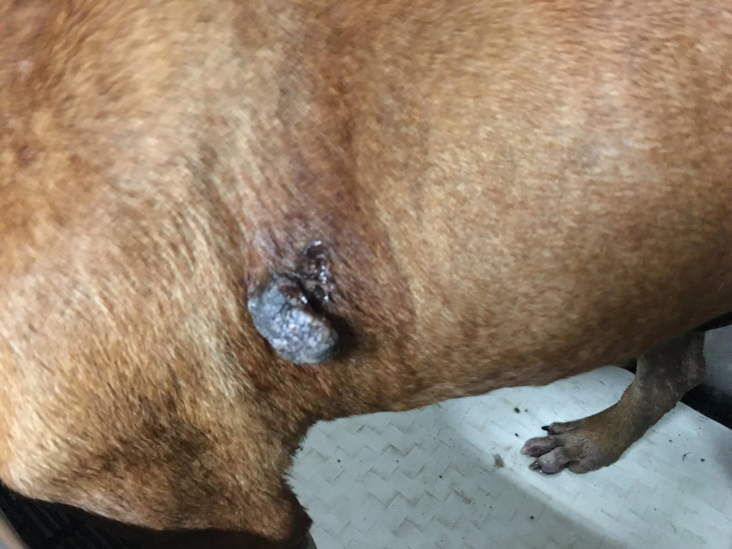 Skin tag, non-cancerous, but will be removed