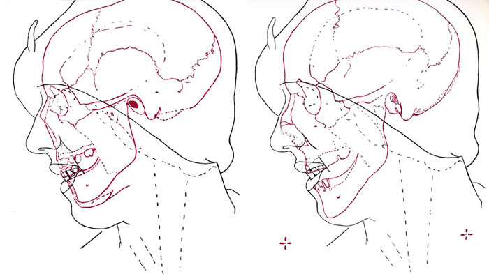 Forensic Evidence Diagram